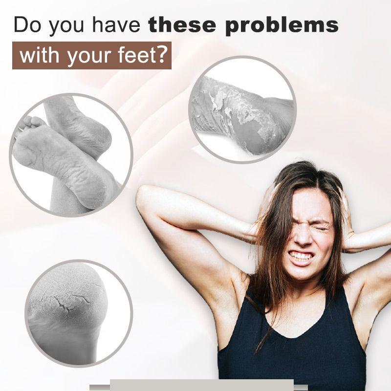 Crème anti-craquelure pour les pieds
