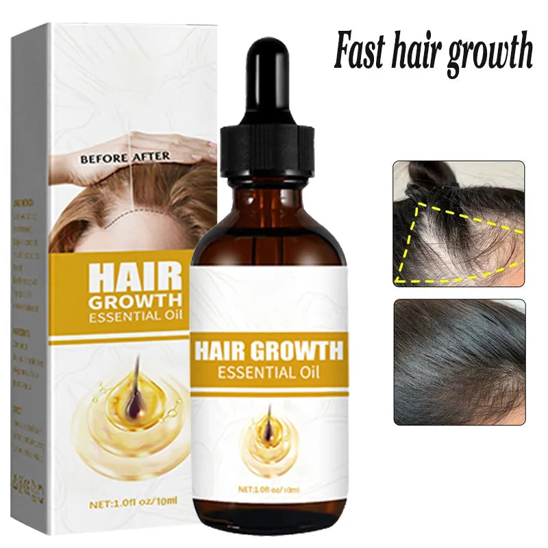 Huile de croissance rapide des cheveux - 2 ACHETÉE = 1 OFFERTE