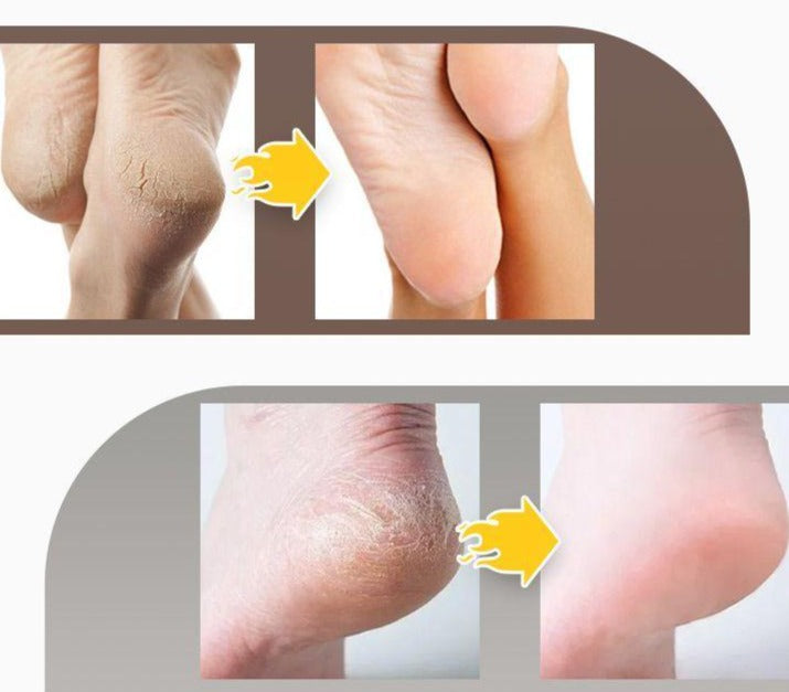 Crème anti-craquelure pour les pieds