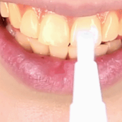 Stylo MAGIQUE dents blanches - DealValley