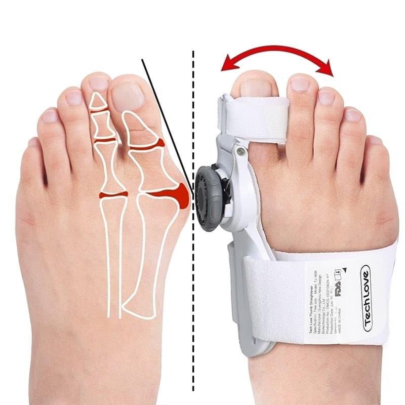 Correcteur Hallux Valgus Efficace - DealValley
