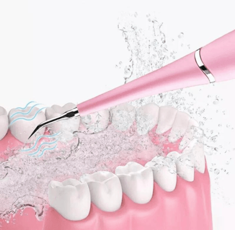Détartreur Dentaire Électrique - DealValley