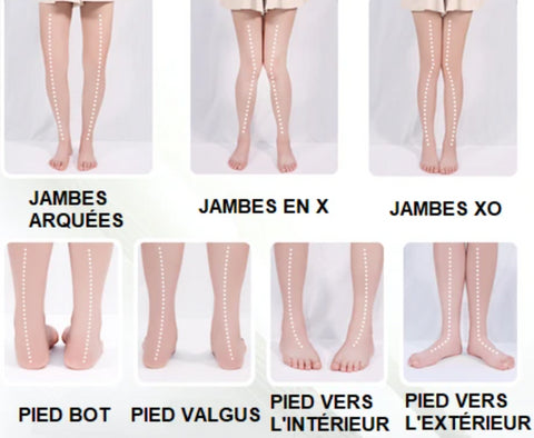 Semelles orthopédiques pour pieds plats - DealValley