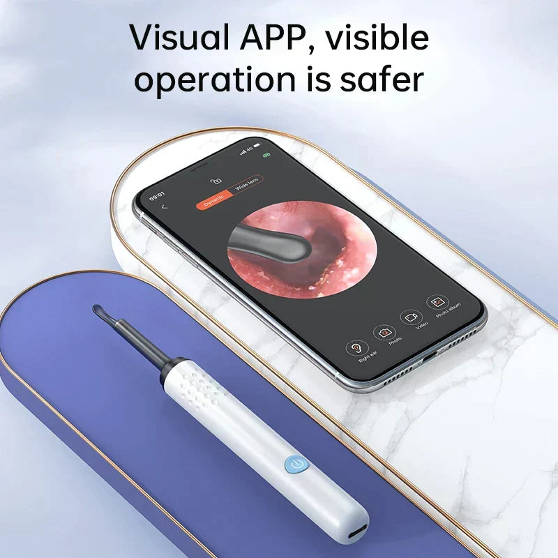 Nettoyeur d'oreille électronique avec caméra endoscopique intégrée - Livraison Offerte