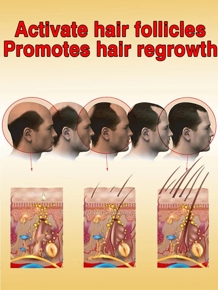 Huile de croissance rapide des cheveux - 2 ACHETÉE = 1 OFFERTE