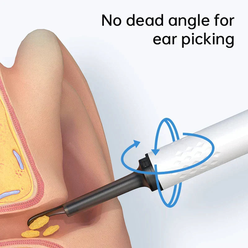 Nettoyeur d'oreille électronique avec caméra endoscopique intégrée - Livraison Offerte