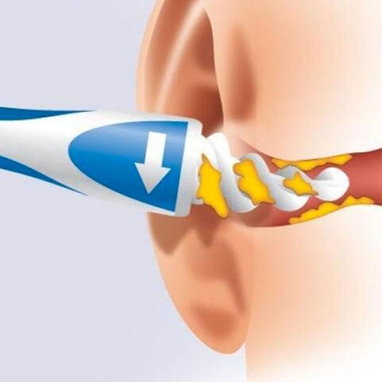 Nettoyeur d'oreille spirale réutilisable - Anti-douleur
